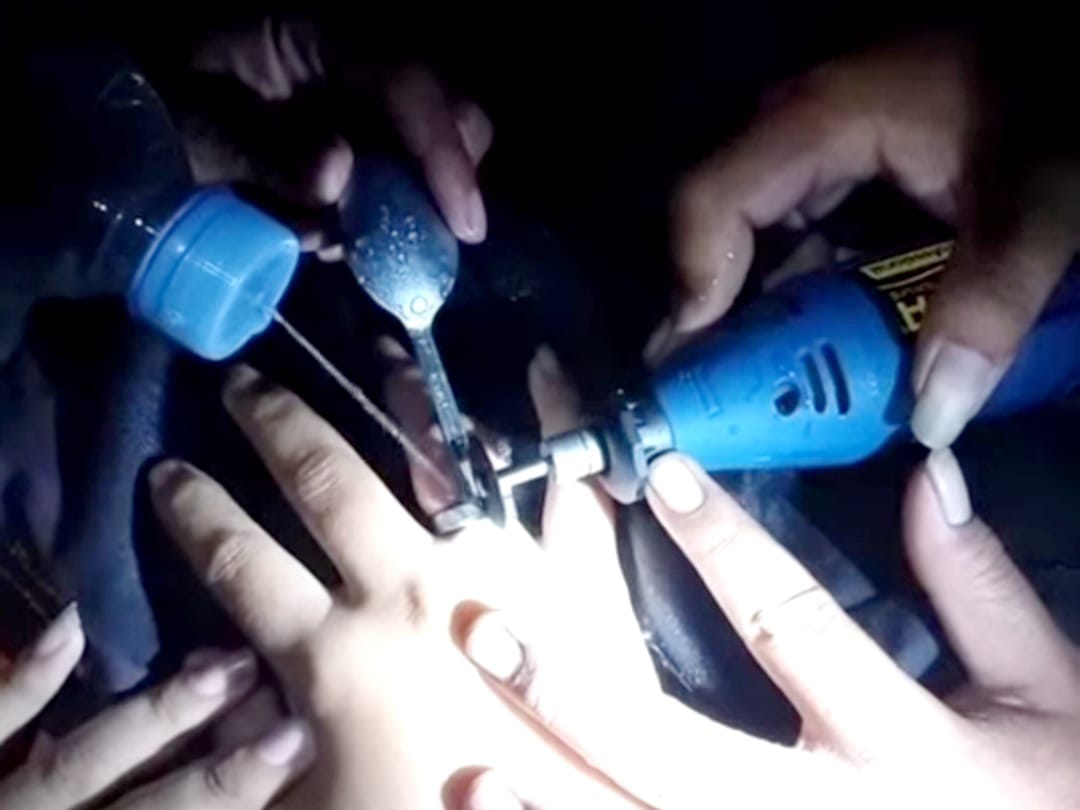 Bangun Tidur Cincin Sulit Dilepas, Wanita Ini Datangi Damkar